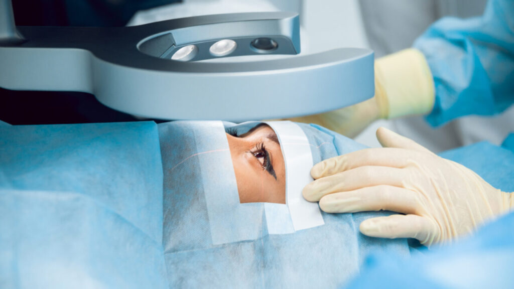 Cataract Surgery Cost