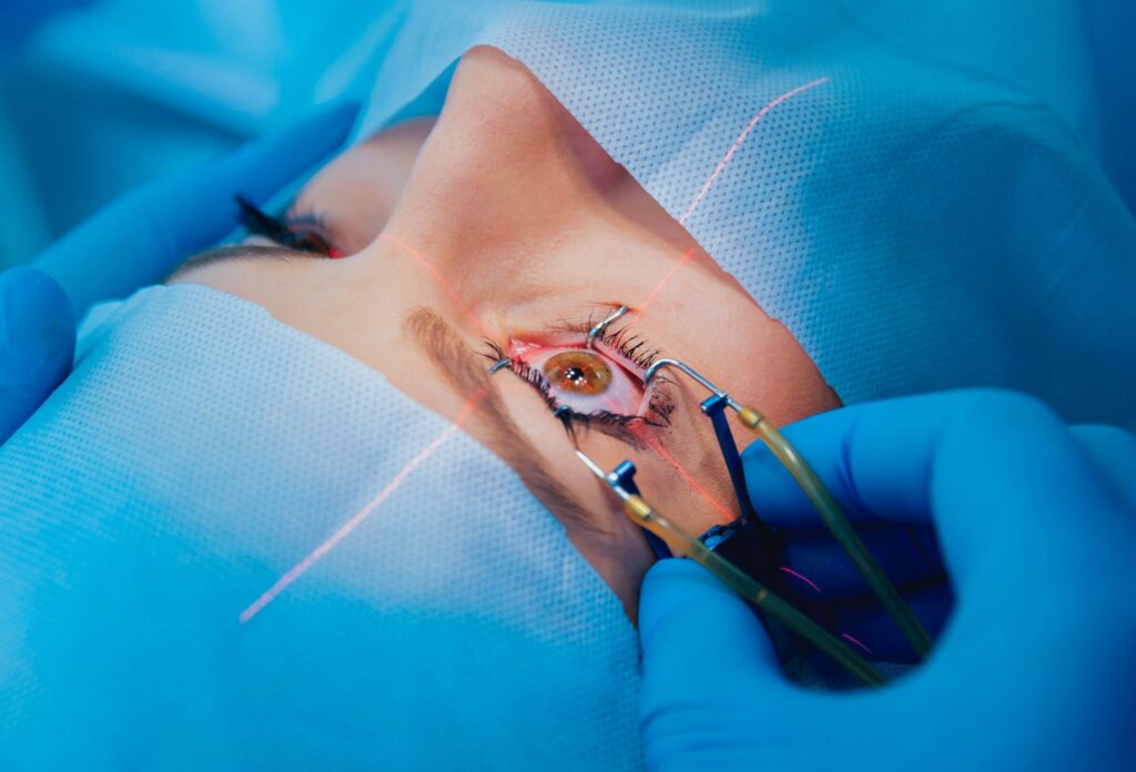 Cataract Surgery Cost